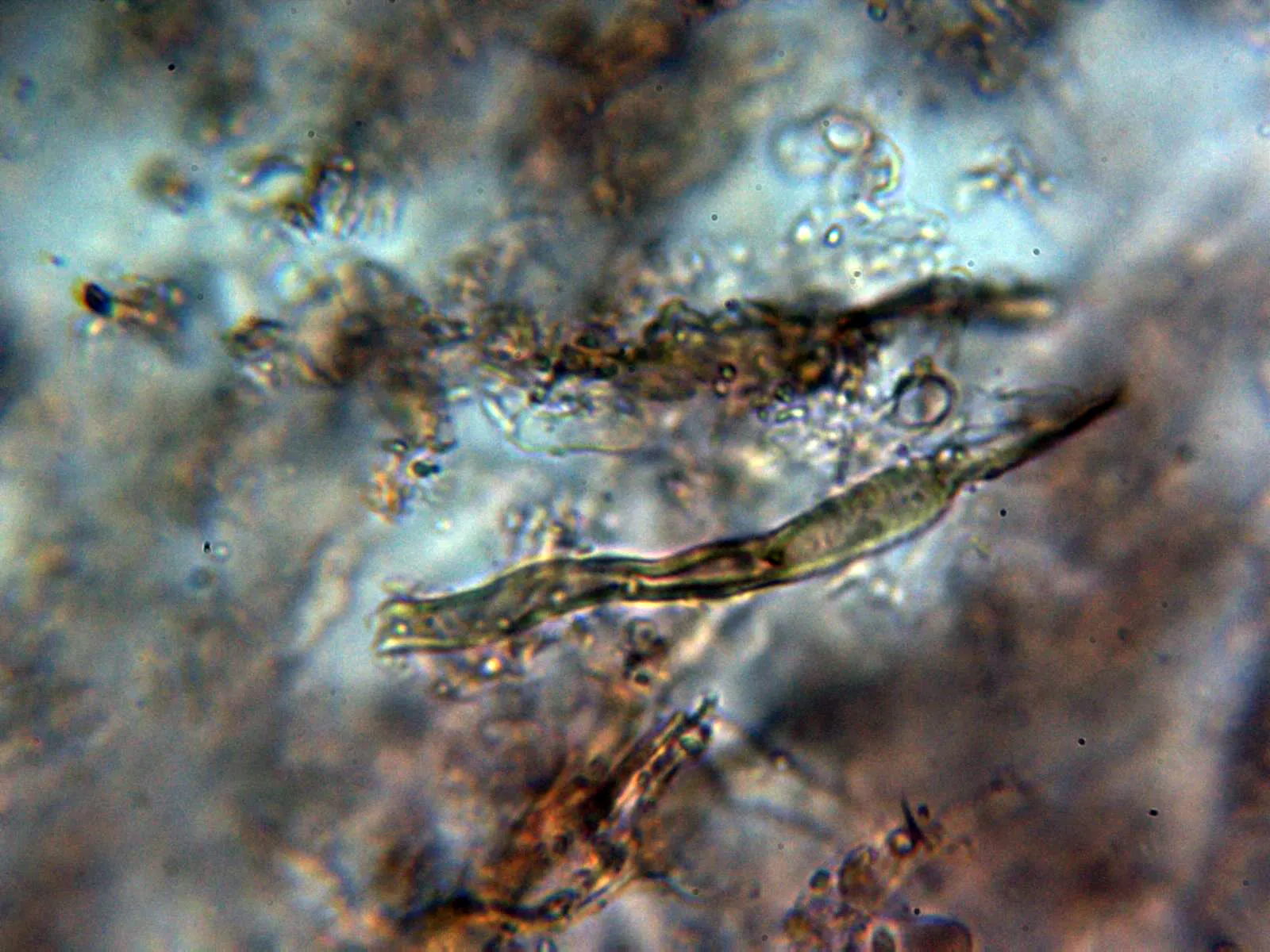 Microscopía de Stereum gausapatum - 10 - Cistidios 1